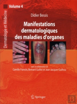 Bertrand.pt - Manifestations Dermatologiques Des Maladies D'Organe