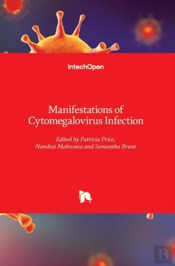 Bertrand.pt - Manifestations Of Cytomegalovirus Infection