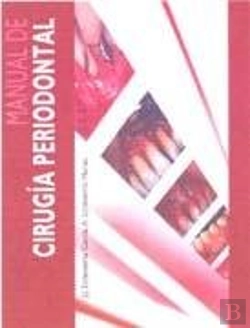 Bertrand.pt - Manual De Cirug¡A Periodontal
