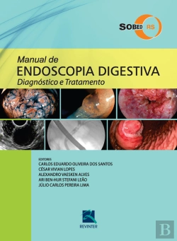 Bertrand.pt - Manual De Endoscopia Digestiva – Sobed/Rs