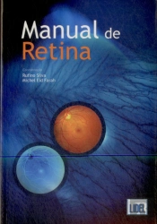 Manual de Retina