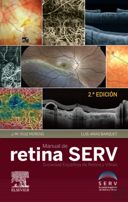 Bertrand.pt - Manual De Retina Serv (2ª Ed.)