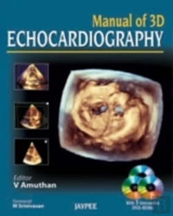 Bertrand.pt - Manual Of 3d Echocardiography