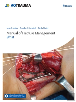 Bertrand.pt - Manual Of Fracture Management - Wrist