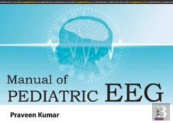 Bertrand.pt - Manual Of Pediatric Eeg