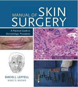 Bertrand.pt - Manual Of Skin Surgery