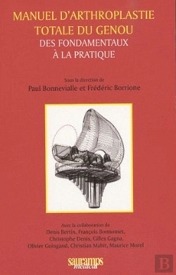 Bertrand.pt - Manuel D'Arthroplastie Totale Du Genou ; Des Fondamentaux À La Pratique