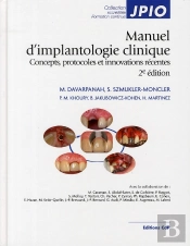 Manuel D'Implantologie Clinique ; Concepts, Protocoles Et Innovations Récentes