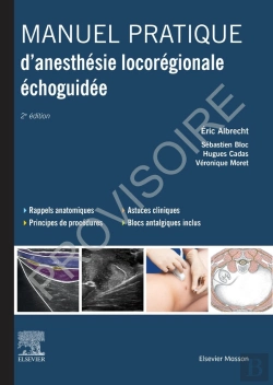 Bertrand.pt - Manuel Pratique D'Anesthesie Locoregionale Echoguidee