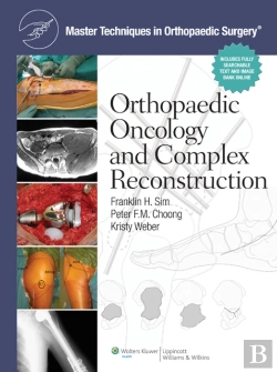 Bertrand.pt - Master Techniques In Orthopaedic Surgery: Orthopaedic Oncology And Complex Reconstruction