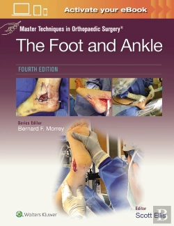 Bertrand.pt - Master Techniques In Orthopaedic Surgery: The Foot And Ankle: Print + Ebook With Multimedia
