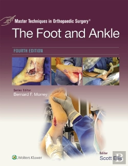 Bertrand.pt - Master Techniques In Orthopaedic Surgery: The Foot And Ankle