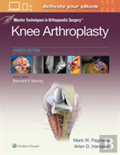 Master Techniques In Orthopedic Surgery: Knee Arthroplasty