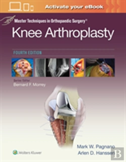 Bertrand.pt - Master Techniques In Orthopedic Surgery: Knee Arthroplasty