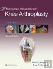 Master Techniques In Orthopedic Surgery: Knee Arthroplasty