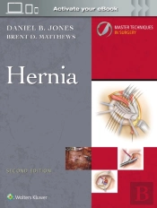 Master Techniques In Surgery: Hernia: Print + Ebook With Multimedia