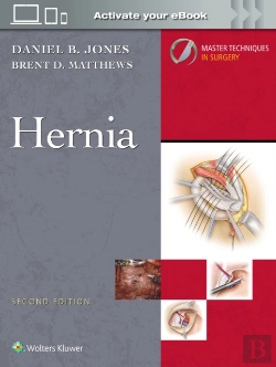 Bertrand.pt - Master Techniques In Surgery: Hernia: Print + Ebook With Multimedia
