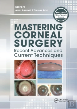 Bertrand.pt - Mastering Corneal Surgery