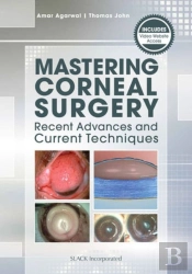 Mastering Corneal Surgery