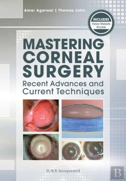 Bertrand.pt - Mastering Corneal Surgery