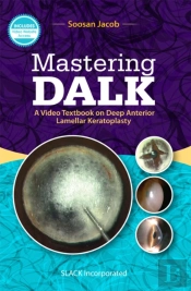 Mastering Dalk