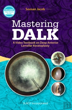 Bertrand.pt - Mastering Dalk