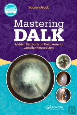 Bertrand.pt - Mastering Dalk
