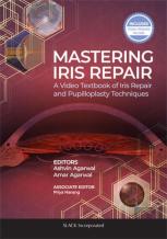 Mastering Iris Repair