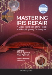 Mastering Iris Repair