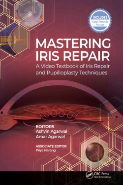 Bertrand.pt - Mastering Iris Repair