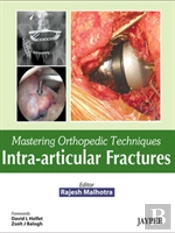 Mastering Orthopedic Techniques: Intra-Articular Fractures