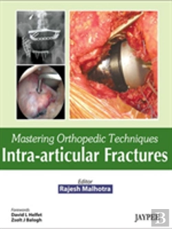 Bertrand.pt - Mastering Orthopedic Techniques: Intra-Articular Fractures