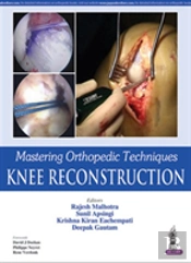 Mastering Orthopedic Techniques: Knee Reconstruction