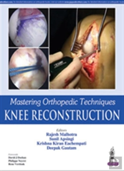 Bertrand.pt - Mastering Orthopedic Techniques: Knee Reconstruction