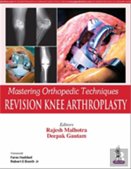 Mastering Orthopedic Techniques: Revision Knee Arthroplasty