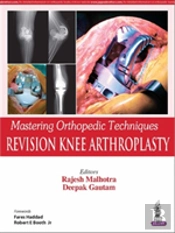 Mastering Orthopedic Techniques: Revision Knee Arthroplasty