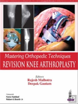 Bertrand.pt - Mastering Orthopedic Techniques: Revision Knee Arthroplasty