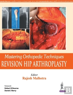 Bertrand.pt - Mastering Orthopedic Techniques: Revision Total Hip Arthroplasty