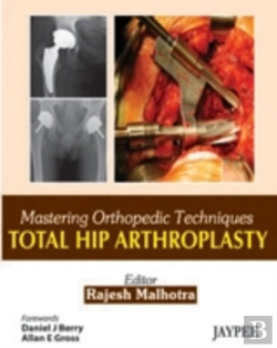 Bertrand.pt - Mastering Orthopedic Techniques: Total Hip Arthroplasty