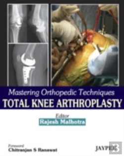 Bertrand.pt - Mastering Orthopedic Techniques: Total Knee Arthroplasty