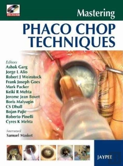 Bertrand.pt - Mastering Phaco Chop Techniques