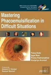 Mastering Phacoemulsification In Difficult Situations