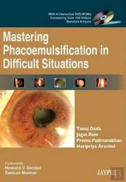 Bertrand.pt - Mastering Phacoemulsification In Difficult Situations