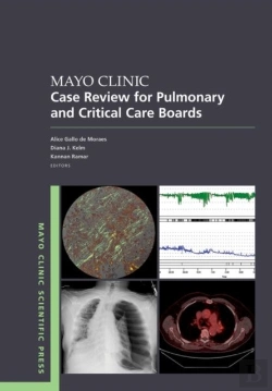 Bertrand.pt - Mayo Clinic Case Review For Pulmonary And Critical Care Boards