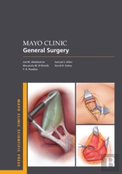 Mayo Clinic General Surgery