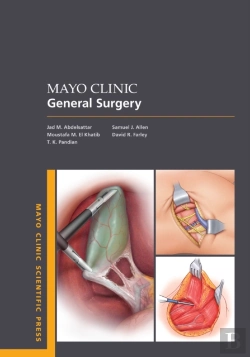 Bertrand.pt - Mayo Clinic General Surgery