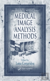 Medical Image Analysis Methods