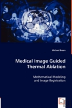 Bertrand.pt - Medical Image Guided Thermal Ablation