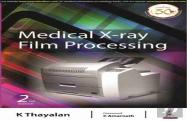 Medical X-Ray Film Processing