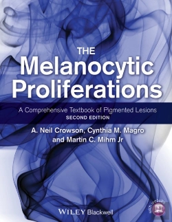 Bertrand.pt - Melanocytic Proliferations